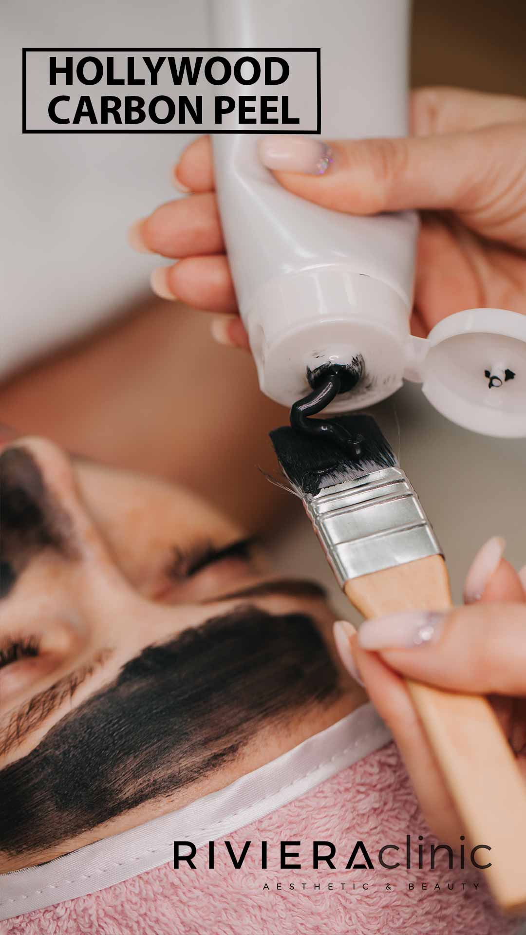 Hollywood Carbon Peel Laser à la RIVIERAClinic Lausanne