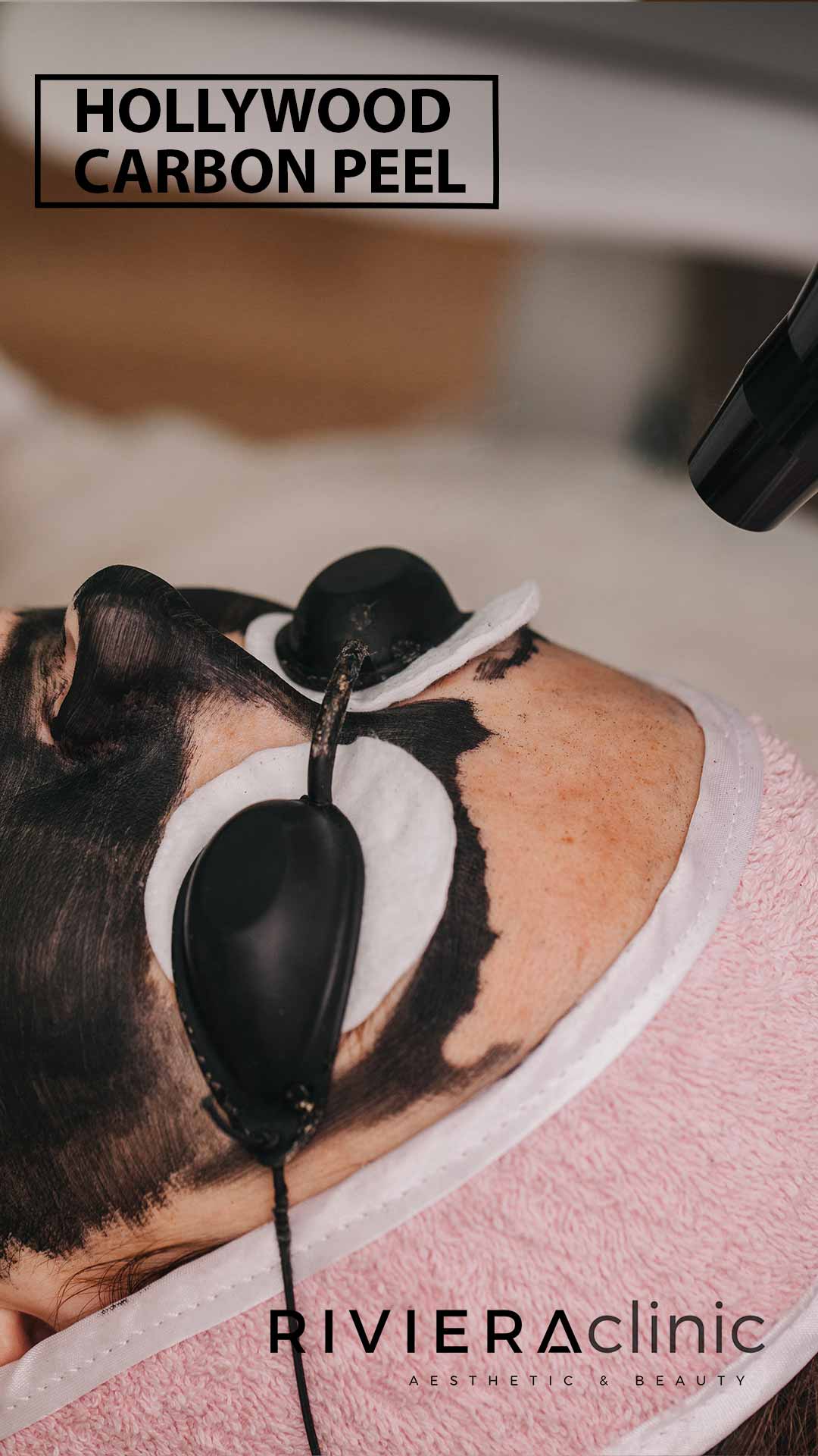 Hollywood Carbon Peel Laser à la RIVIERAClinic Lausanne pour une peau nette et assainie