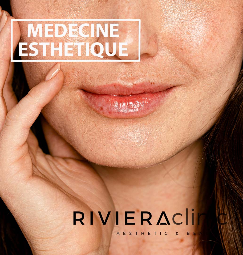 Médecine esthétique à la RIVIERAClinic : toxine botulique, acide hyaluronique, mésothérapie, prp