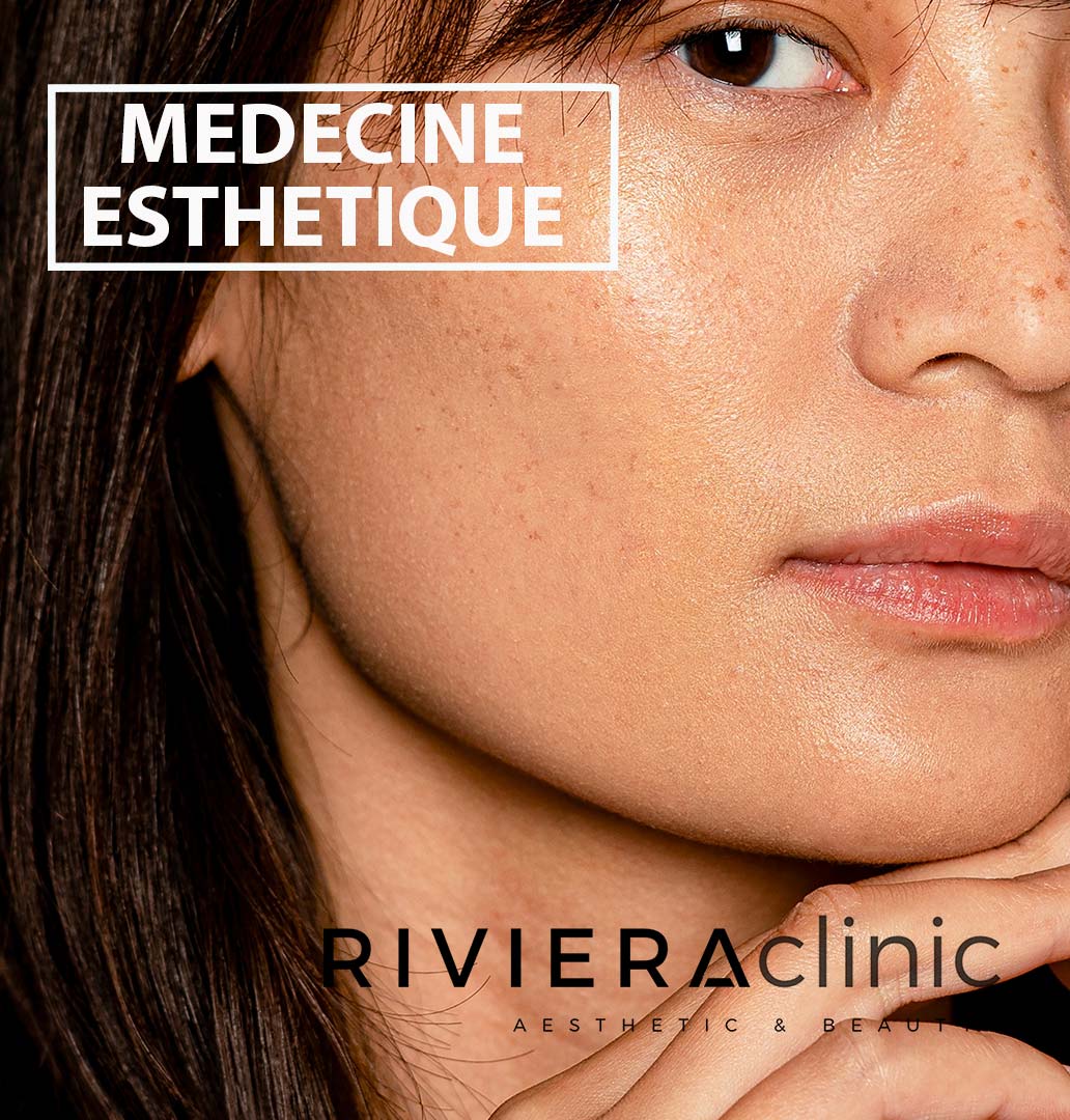 Médecine esthétique à la RIVIERAClinic : toxine botulique, acide hyaluronique, mésothérapie, prp