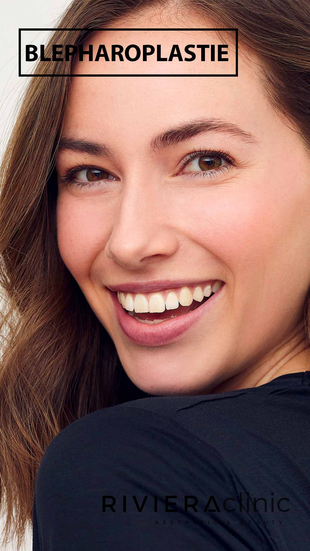 blepharoplastie chirurgie des paupières par le Dr SMARRITO