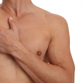 En savoir plus sur la gynécomastie à la RIVIERACLINIC