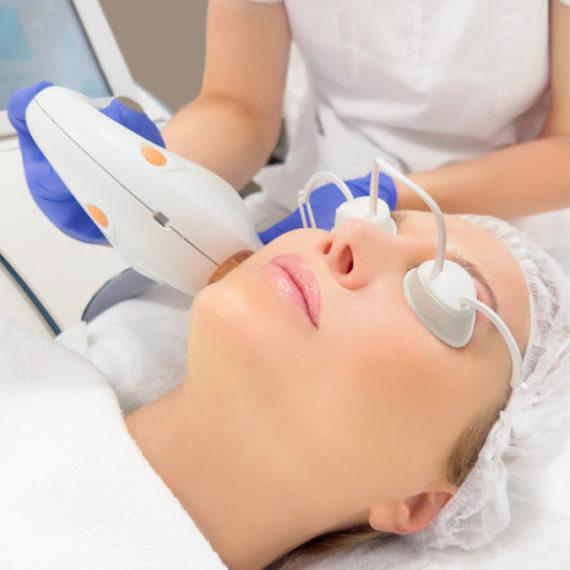 épilation laser : comment le laser fonctionne