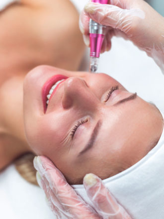 Soin expert RIVIERAClinic avec microdermabrasion, needling et LED