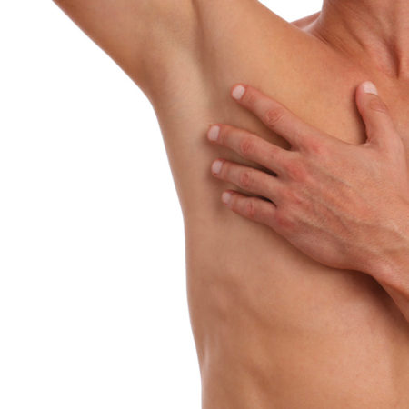 Article sur la transpiration excessive et épilation laser
